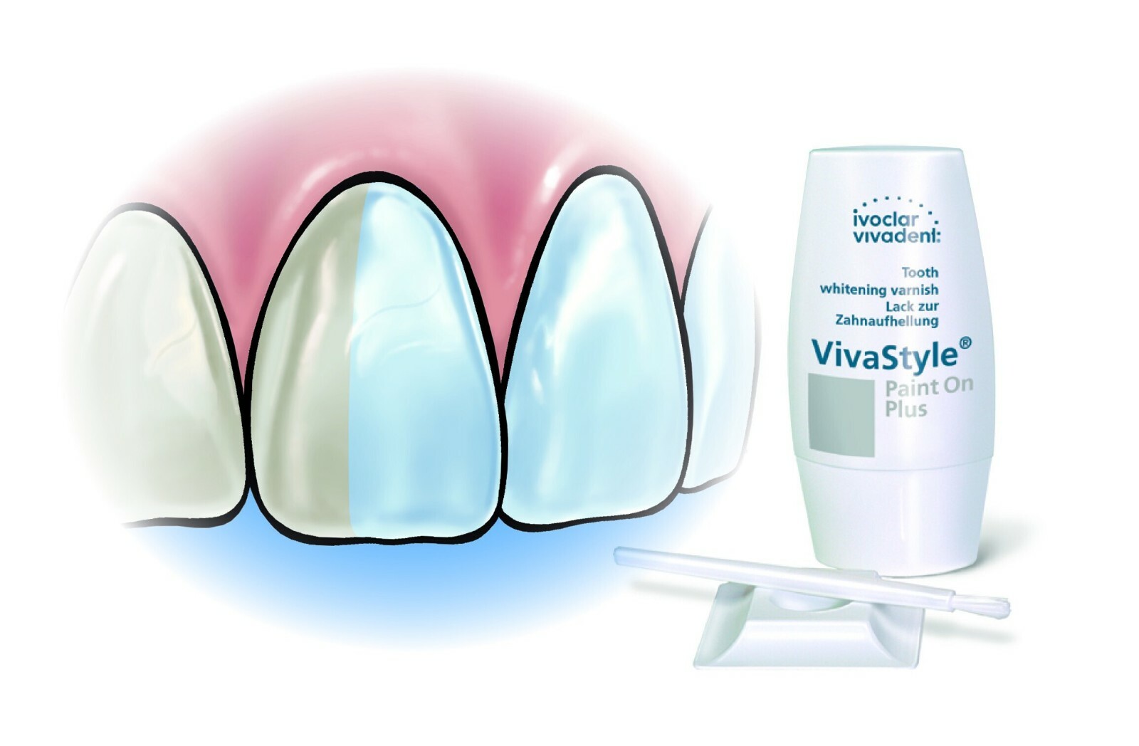 Ivoclar Vivadent VivaStyle Paint On Plus Patient Bleach Kit with Varnish System