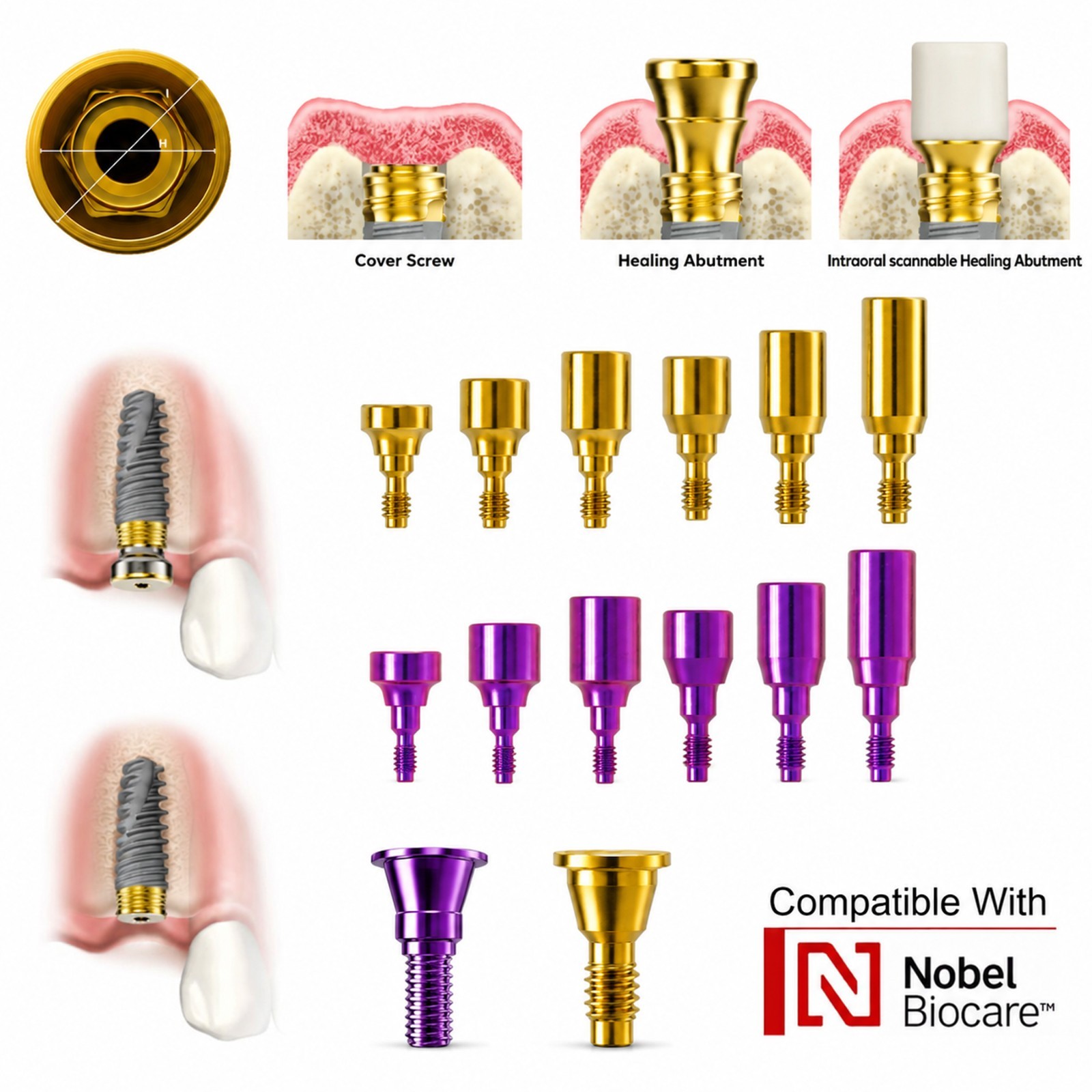 US Dental Healing Abutment Closure Caps Fit NobelActive Conical Connection NP/RP