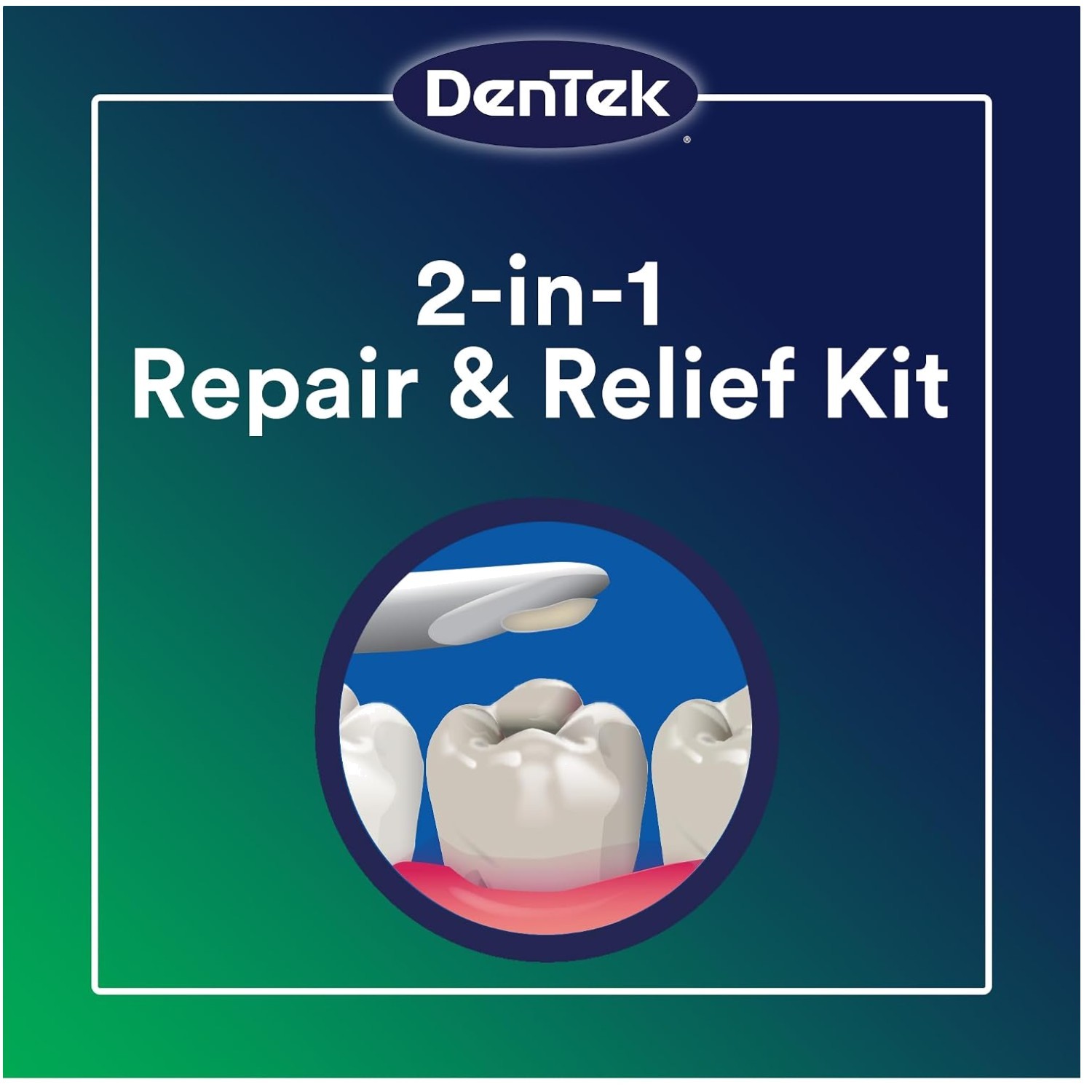 Temparin Max Lost Filling Repair, 24 Pack, 5+ Repairs
