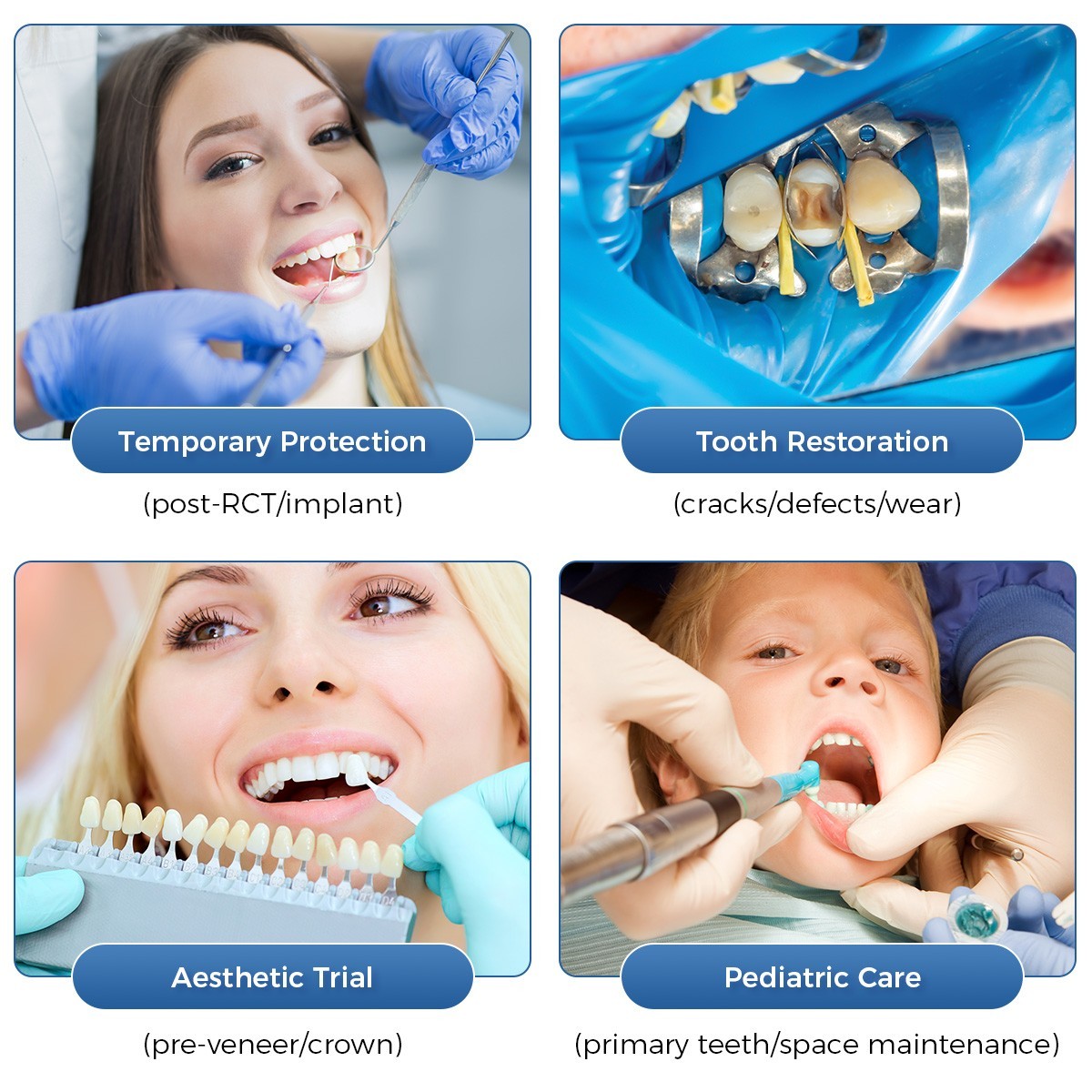 Temporary Dental Crown Resin Anterior Posterior Teeth Mixed Sizes Natural Color