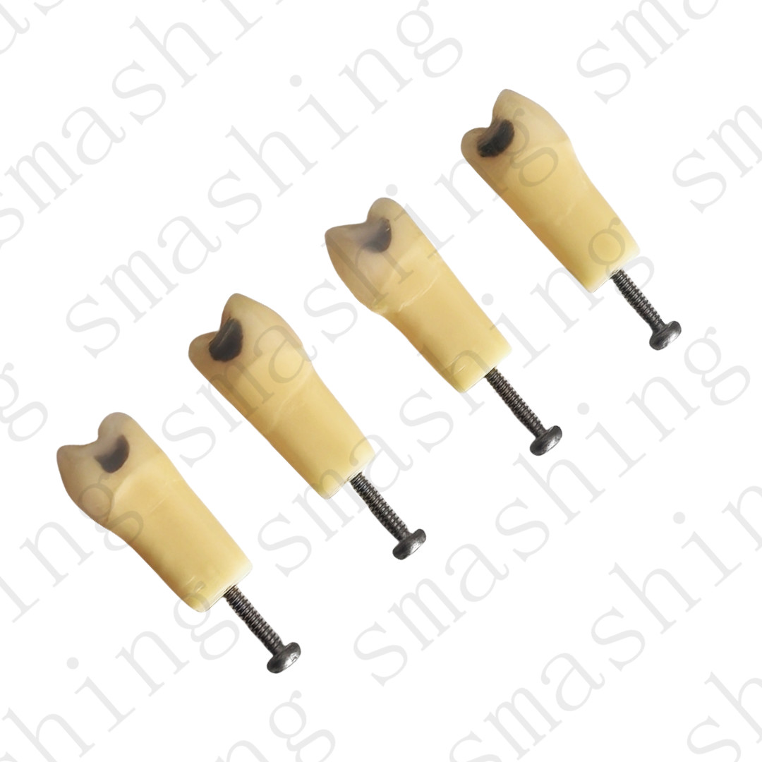 10Pcs New Dental Cavity Teeth Model Tooth Teaching Caries 25# Fit Frasaco AG-3