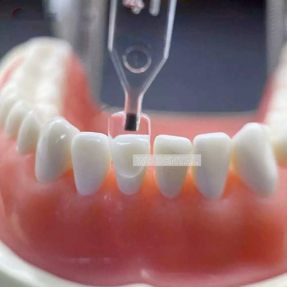 Dental Veneers Mould Composite Resin Anterior Front Teeth Light Cure Restoration