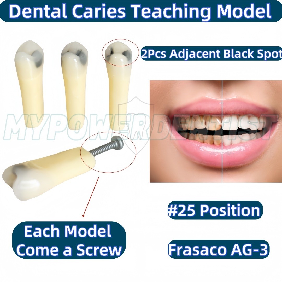 25# Dental Cavity Teeth Model Tooth Teaching Caries ModelCompatible Frasaco AG-3