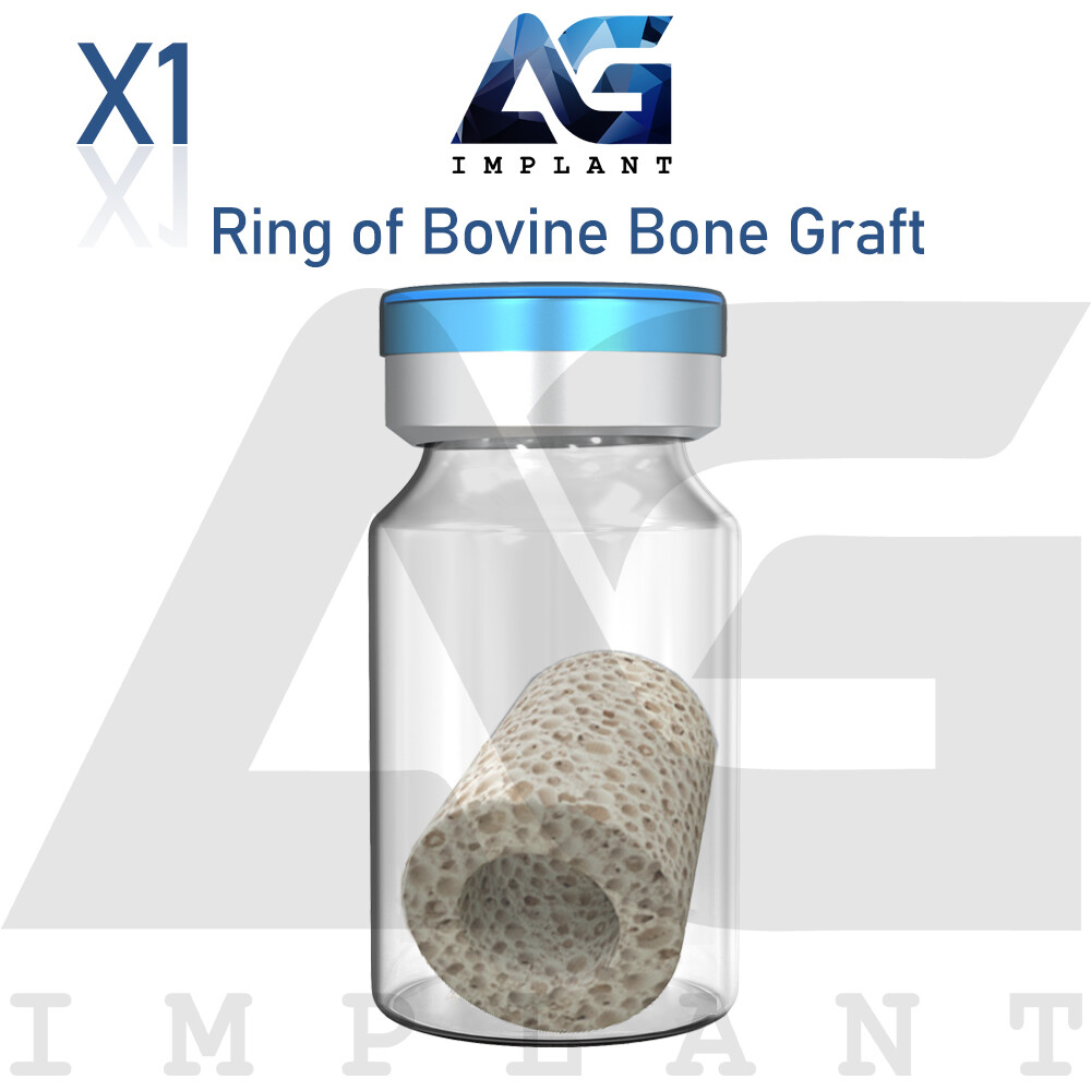 3D Ring Of Natural Graft Material Sterile Blister Immediate Load Sockets