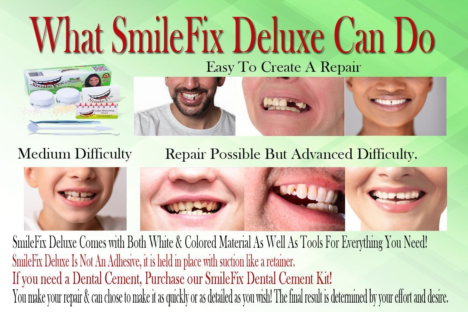 SmileFix Deluxe Dental Repair Kit – Color Matching 1 Ounce (Pack of 1), White