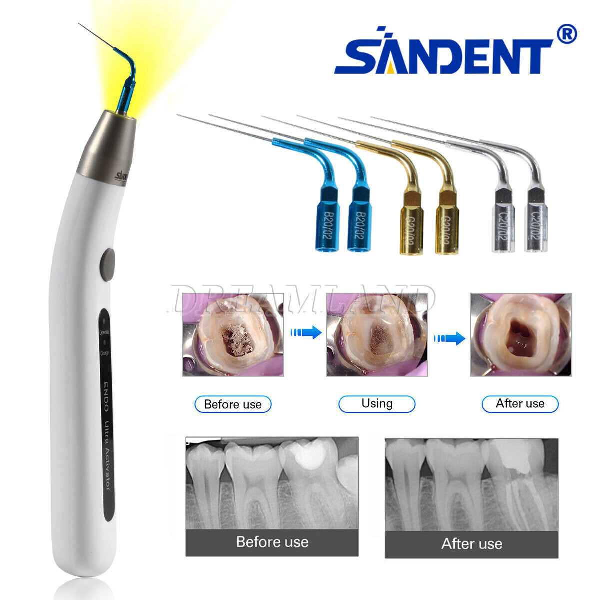 Sale Endo Ultra Activator Irrigation Root Canal Irrigator Tips Ultrasonic