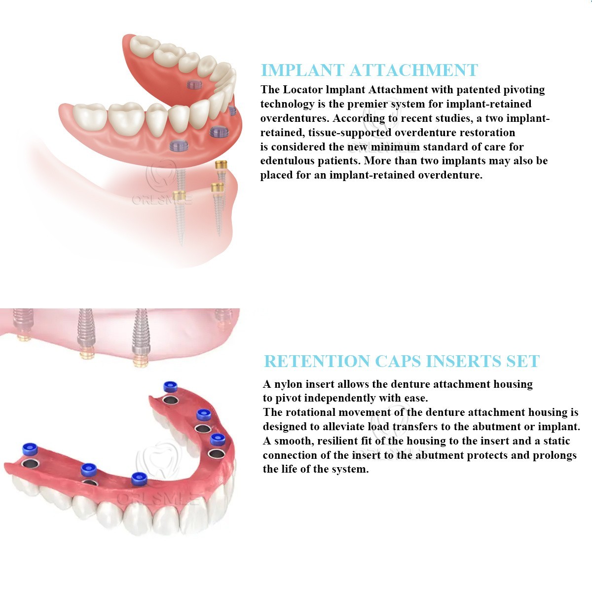 Locator abutment with Standard Males fit to Osstem TS GH1-6 Mini Regular