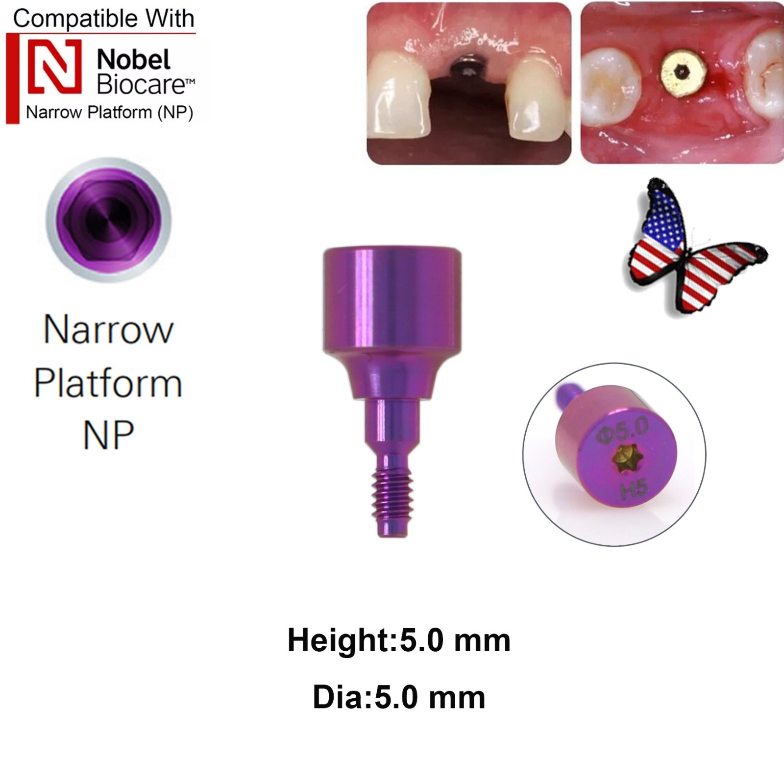 5Pcs Nobel active Healing Abutment Cover Screw Healing Screw Gum Molding Implant