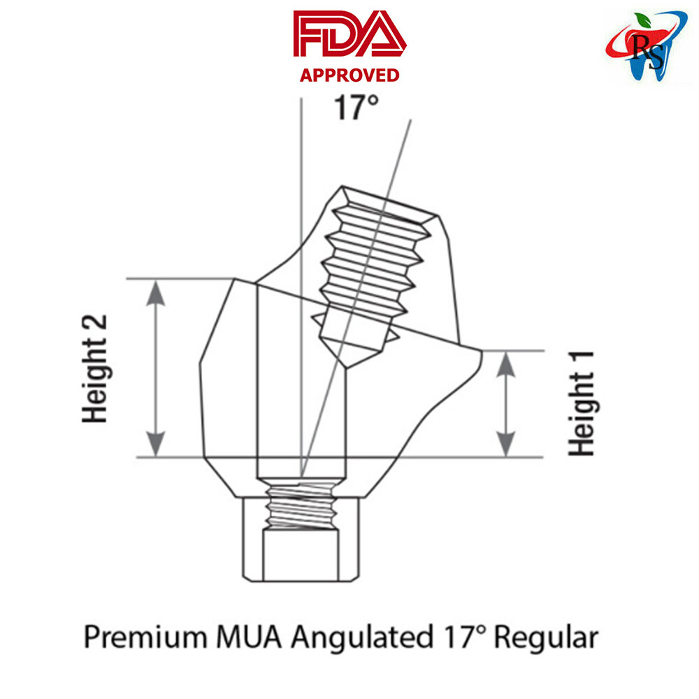 1x Set Dental Angulated 17° Multi-Unit 1.6 RP Int Hex 2.42mm + Titanium Sleeve