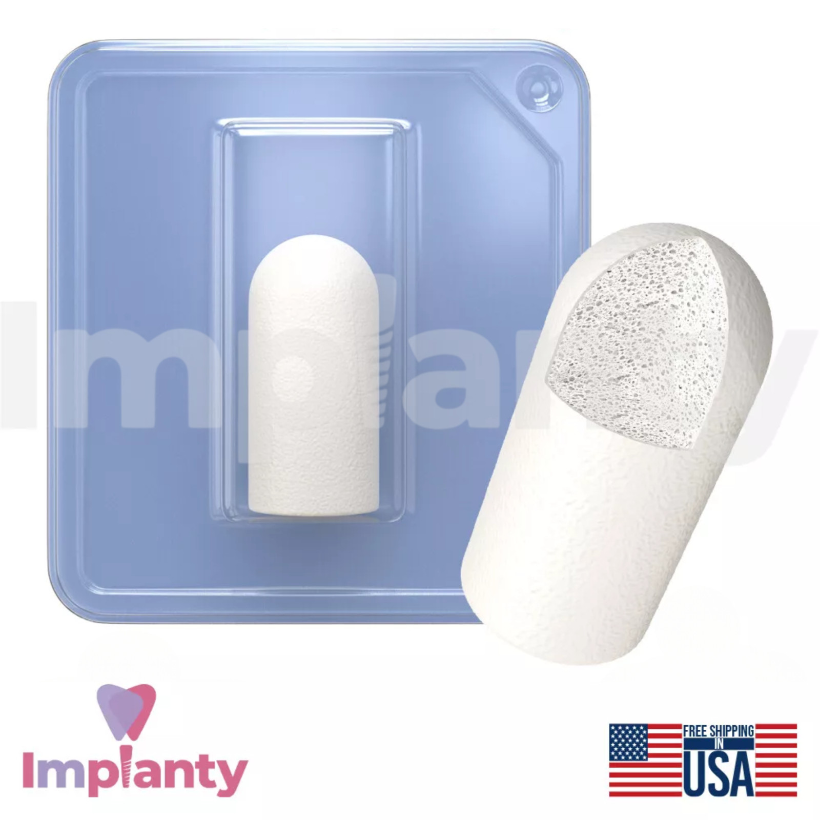 GDT Dental Sponge Grafting Plug Collagen Type I Coating Sterile Ø10.0mm Diameter