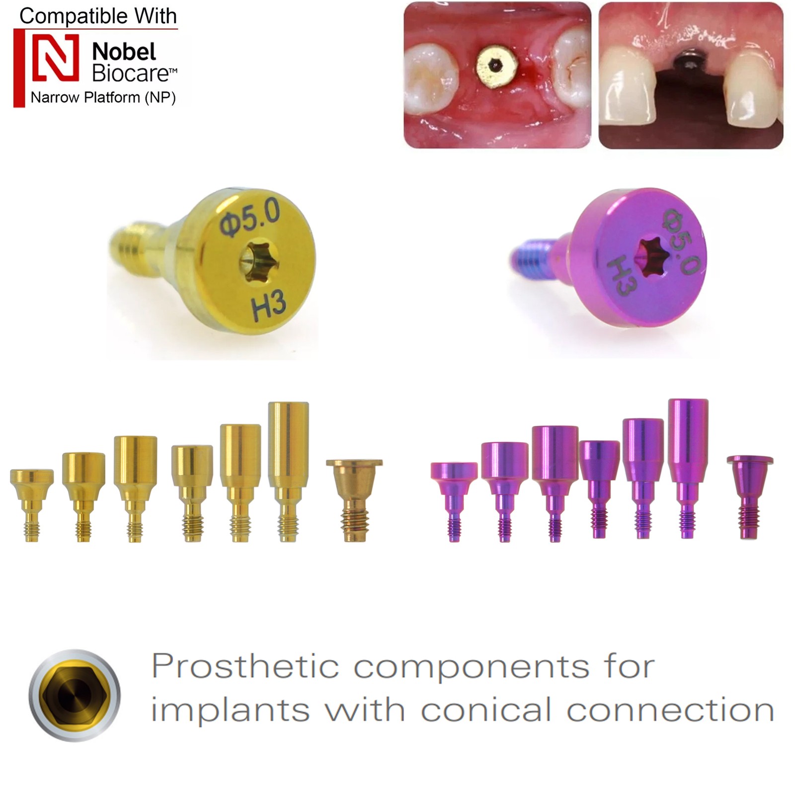 US Nobel Biocare Hex Locator/Healing Cap/Abutment /Impression Coping Accessories