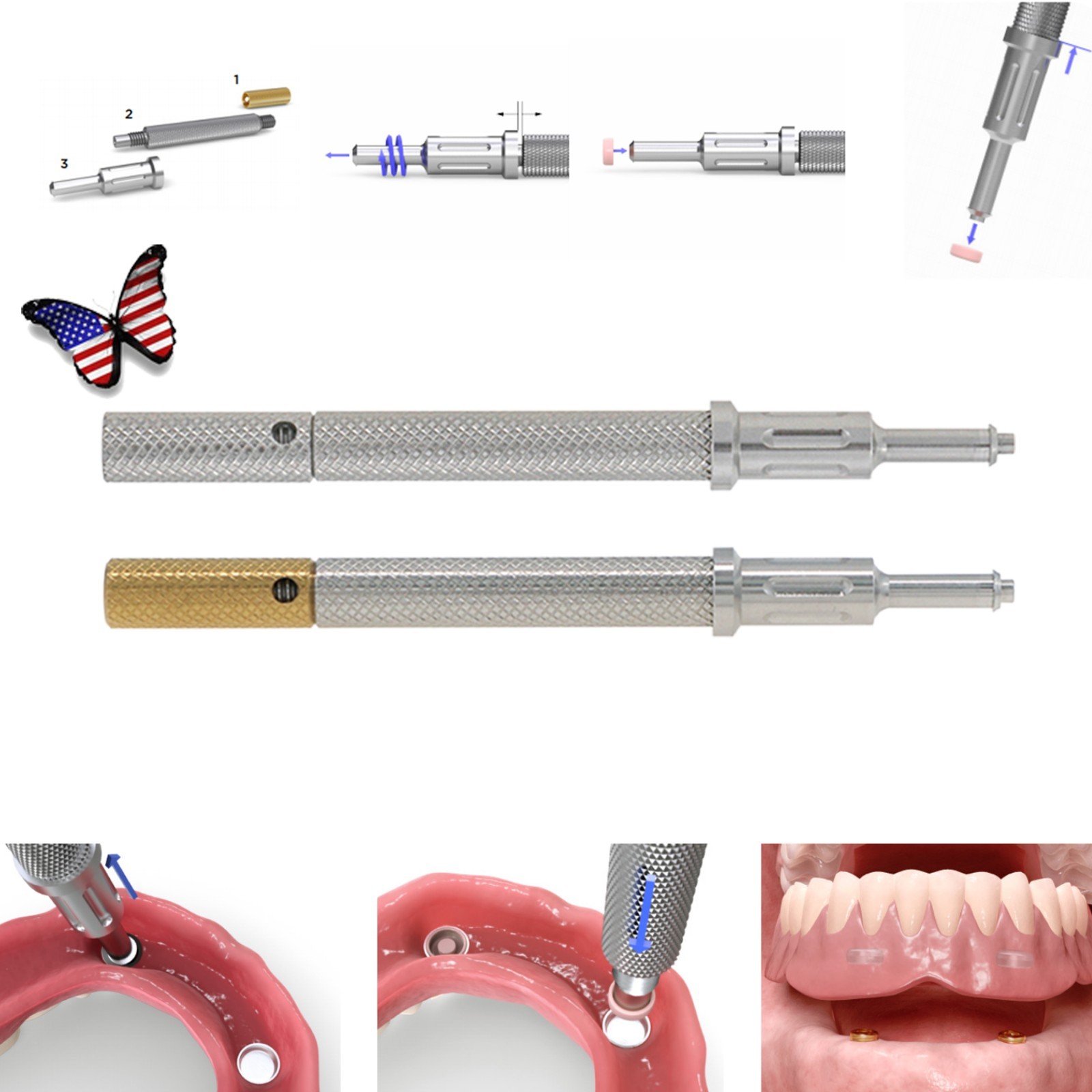 US Dental Locator Core Tool 3-in-1 Insertion Removal Driver Zest Locator Legacy
