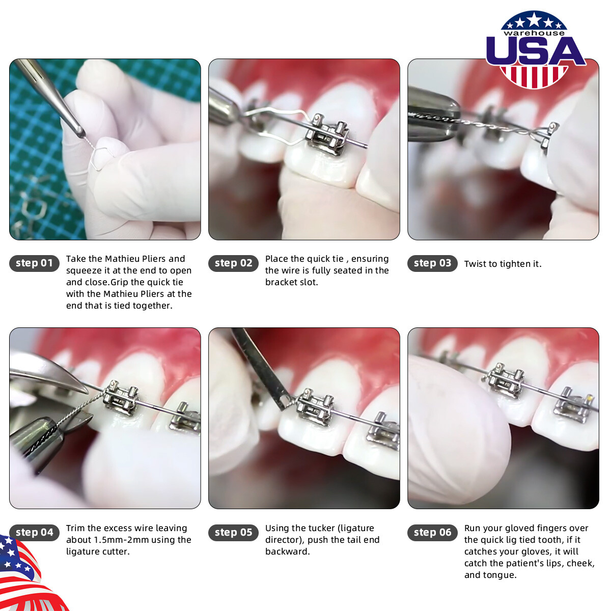 Dental Orthodontic Wire Preformed Kobayashi Ligature Tie Medical Stainless Steel