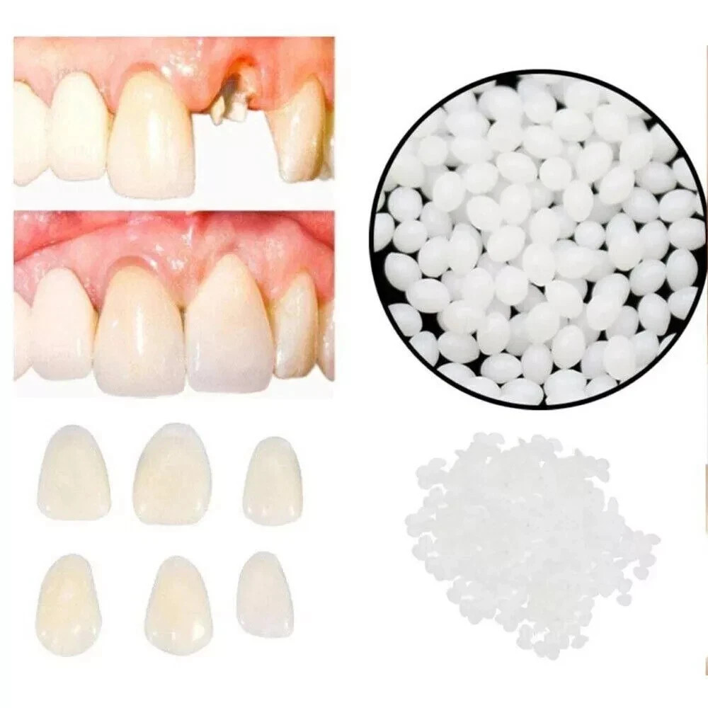 Dental Thermal Fitting Beads Replacement Temporary Tooth Denture 25g Material
