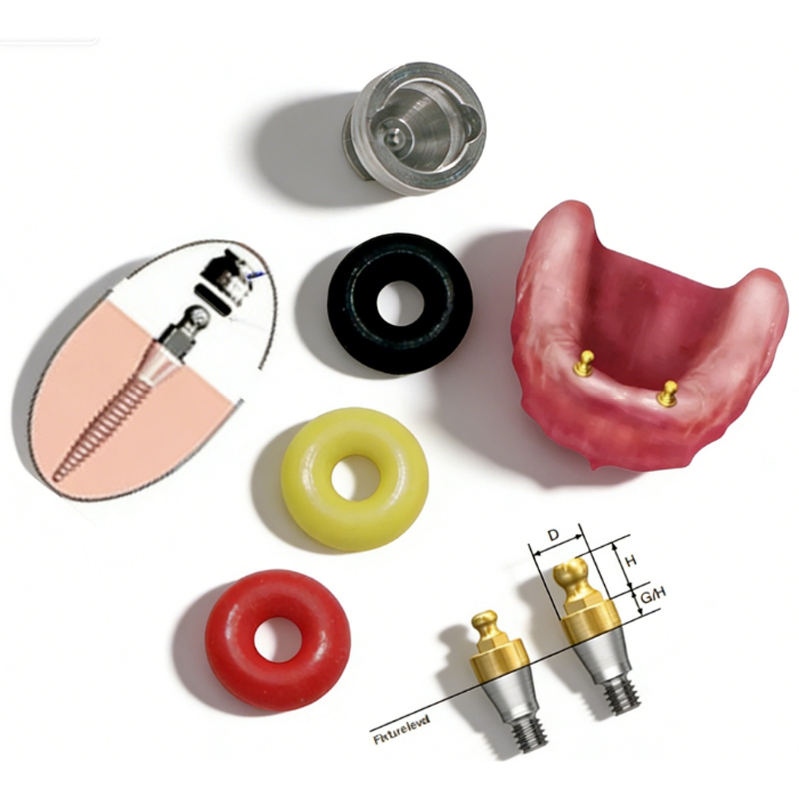 US Dental Hiossen/Osstem Fit Ball Abutment O-Ring Retention Kit Overdenture Caps