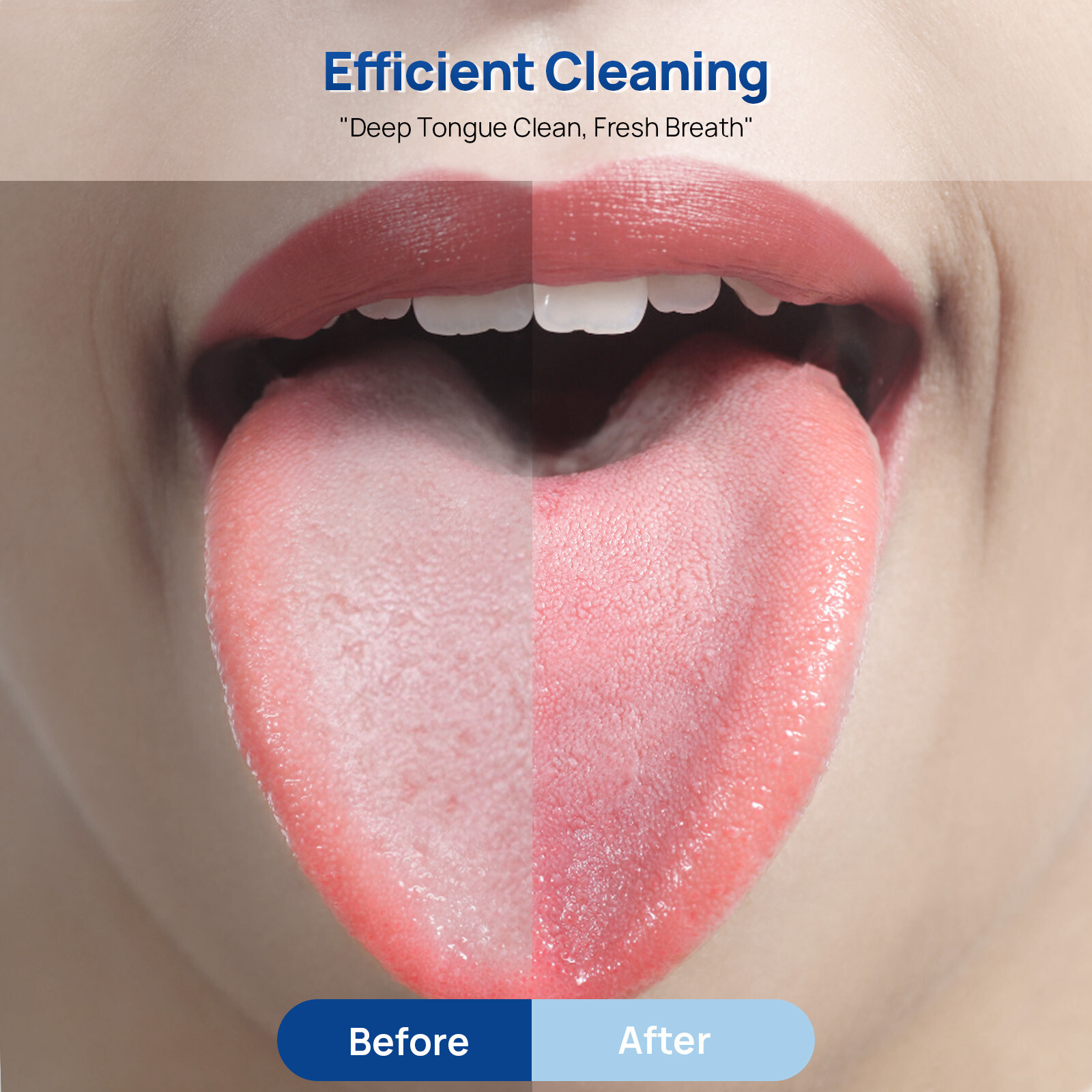 JMU Dental Tongue Scraper 304 Stainless Steel Tongue Cleaner