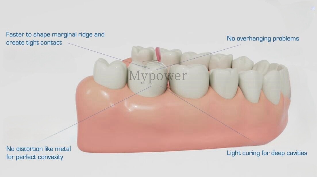 Dental Clear Matrix Anterior/Posterior Teeth Transparent Matrix Fit Bioclear BT