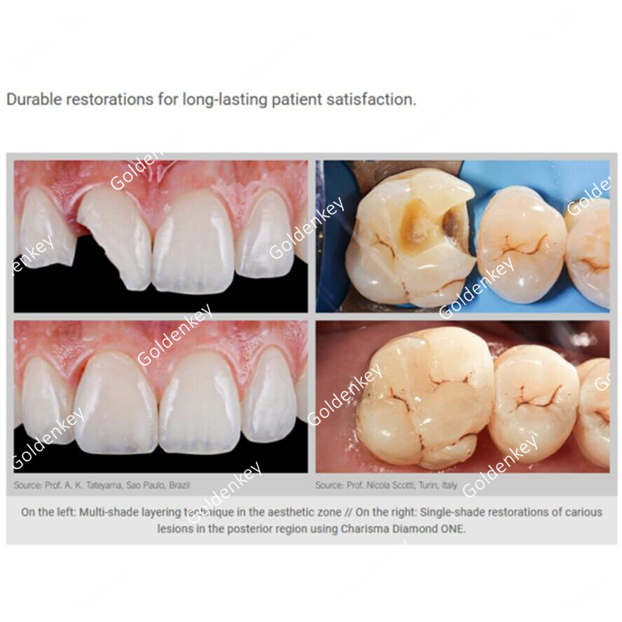 Dental KULZER CHARISMA Diamond OB Light Cure Composite Resin BL BXL Super White