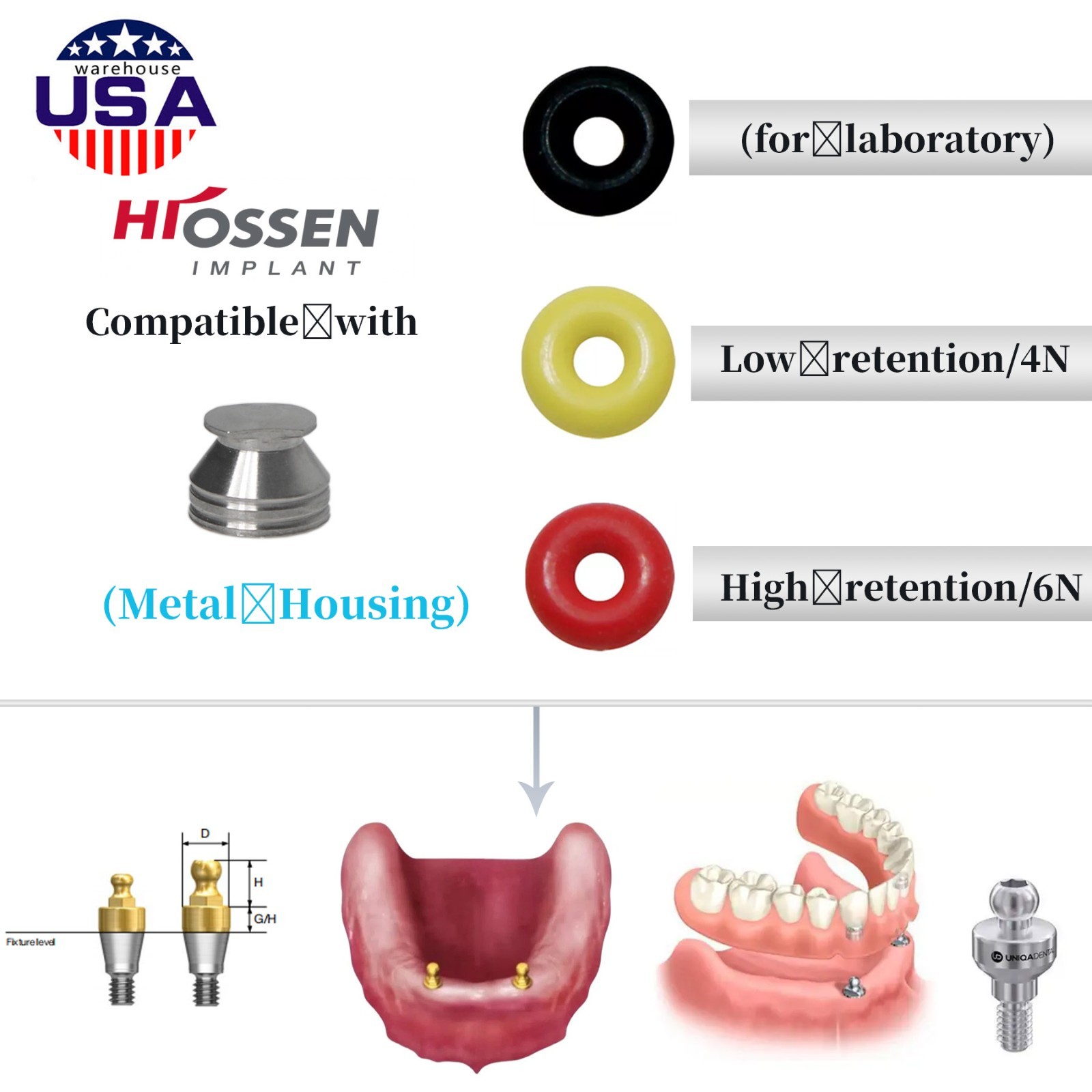 US Dental Hiossen/Osstem Fit Ball Abutment O-Ring Retention Kit Overdenture Caps