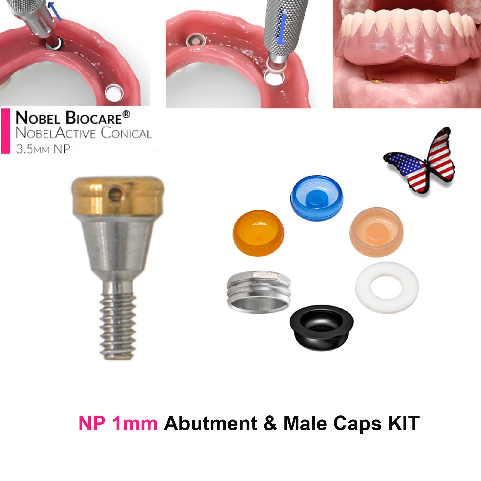 US Nobel Biocare Active NP/RP Hex Locator/Healing Abutment/ Impression Transfer