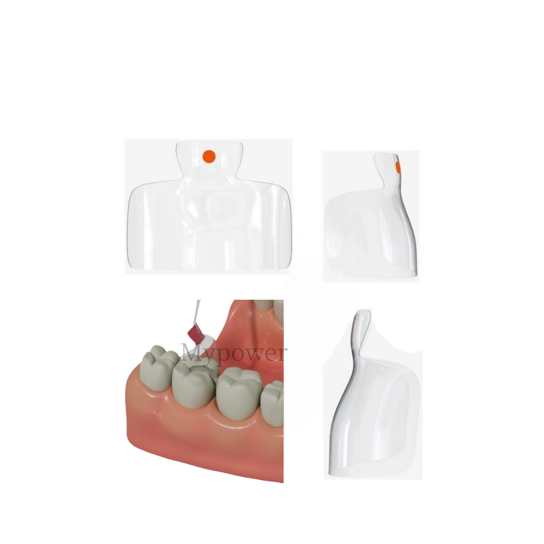 Dental Clear Matrix Anterior/Posterior Teeth Transparent Matrix Fit Bioclear BT