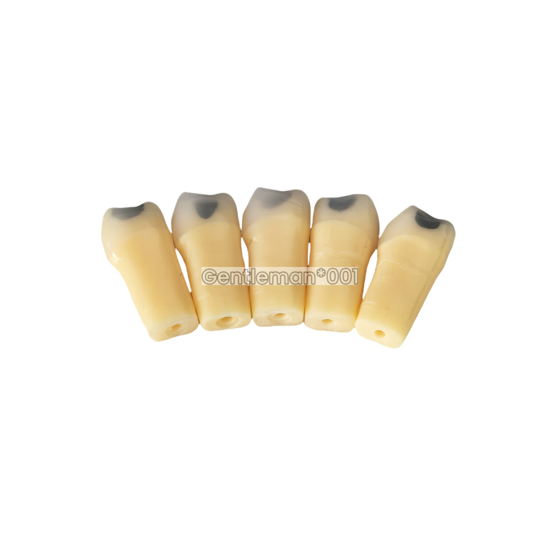 Dental Cavity Teeth Teaching Caries Model Teaching Fits Frasaco AG-3 #25