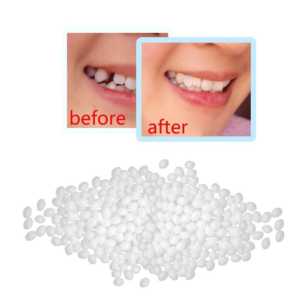 Dental Thermal Fitting Beads Replacement Temporary Tooth Denture 25g Material