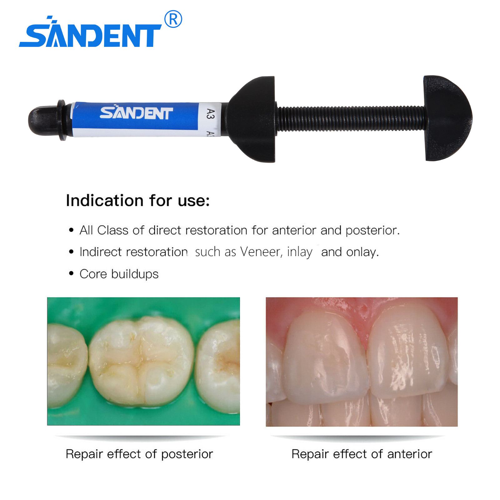 Dent Light Cure Hybrid Composite Dental Resin Shade A3 -4.5 g syringe 001-001 OR