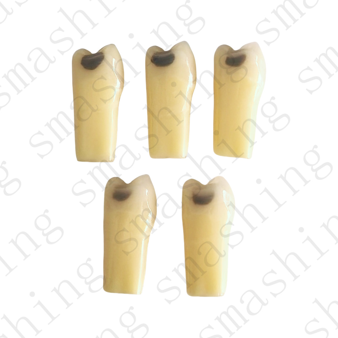 10Pcs New Dental Cavity Teeth Model Tooth Teaching Caries 25# Fit Frasaco AG-3