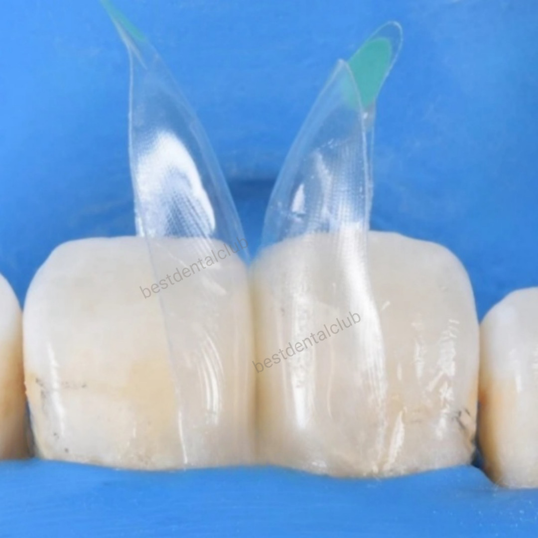Dental Transparent Anterior Distal Front Teeth Matrice Fit Bioclear W2