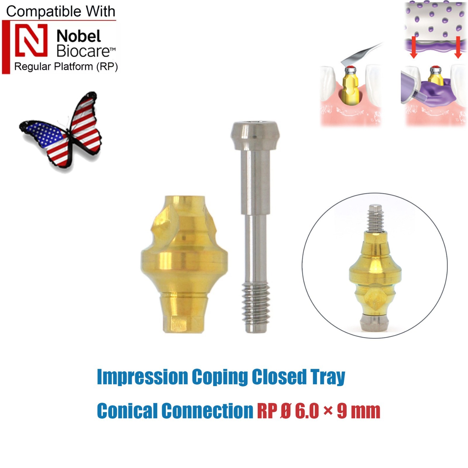 Dental Nobel Active Impression Transfer Coping Open Closed Tray For CAD/CAM Lab