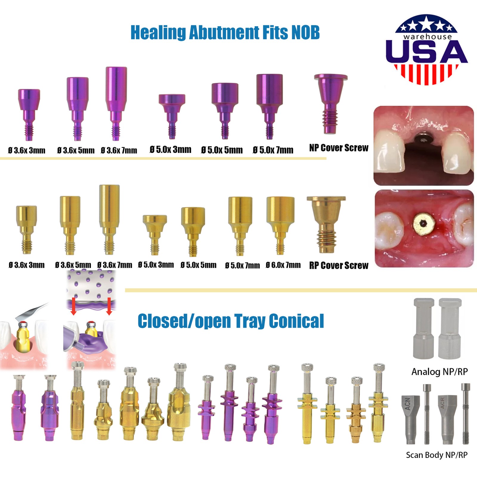 US Nobel Biocare Hex Locator/Healing Cap/Abutment /Impression Coping Accessories