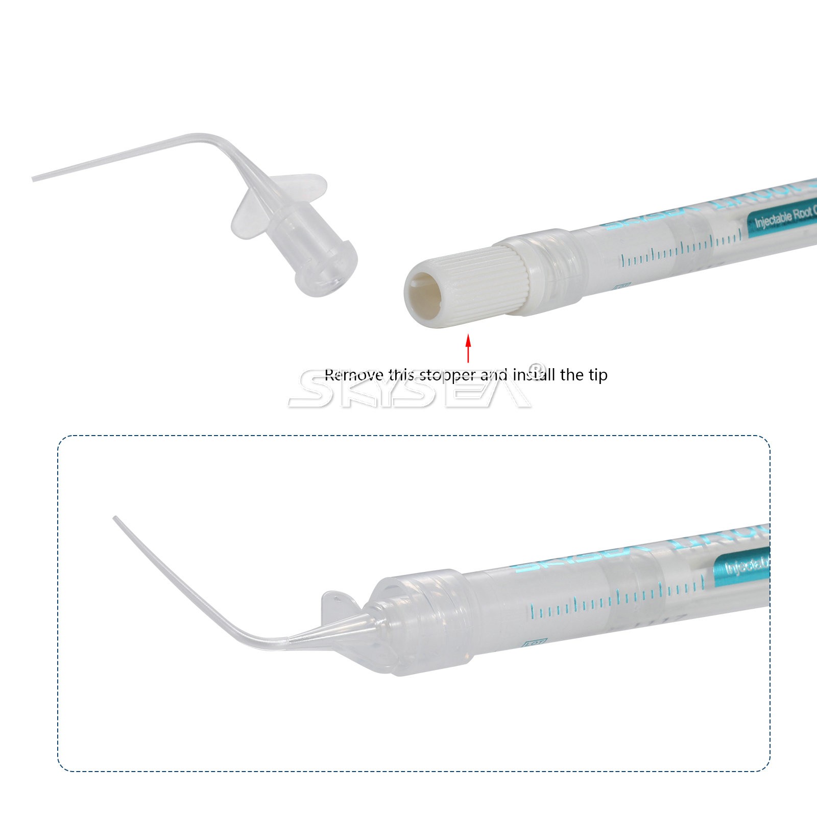 1g nRoot SP Injectable Root Canal Bioceramic Sealer 1g Syringe + 10Tips Dental