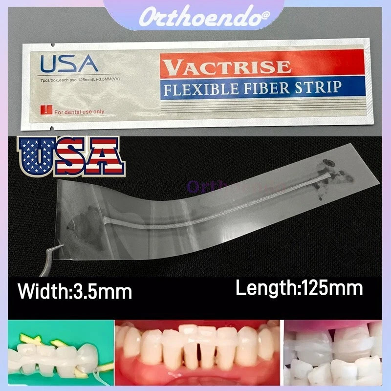 Dental Composite Bonding Flexible Fiber Strip Glass Fiber Splint Ribbond Ribbon