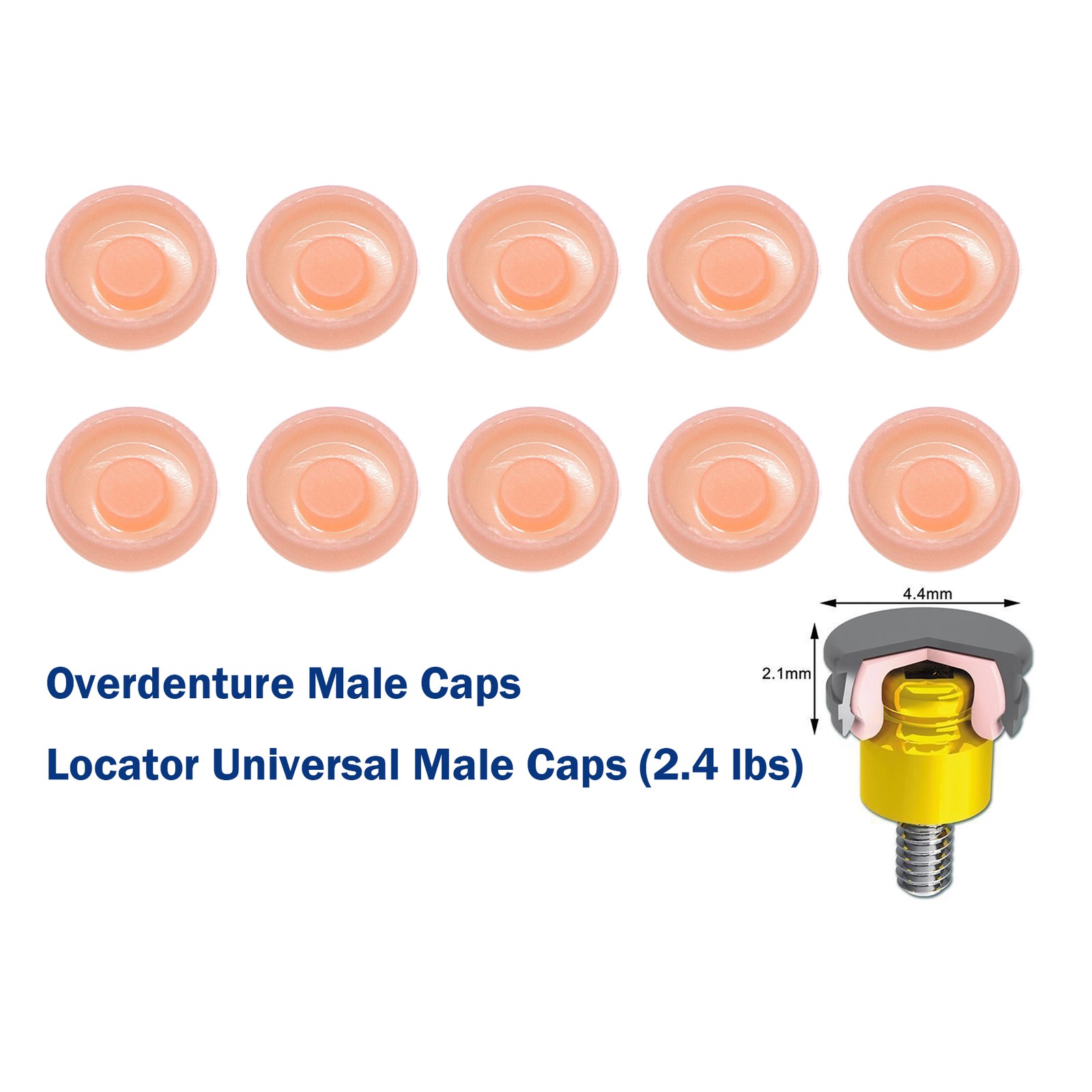 Locator Abutment Overdenture Implant Retention Caps Inserts Zimmer/Nobel/Hiossen