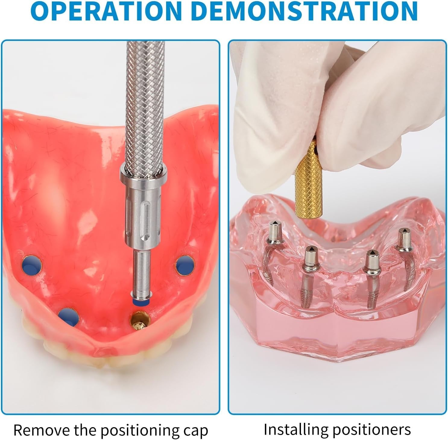 US Dental Locator Core Tool 3-in-1 Insertion Removal Driver Zest Locator Legacy