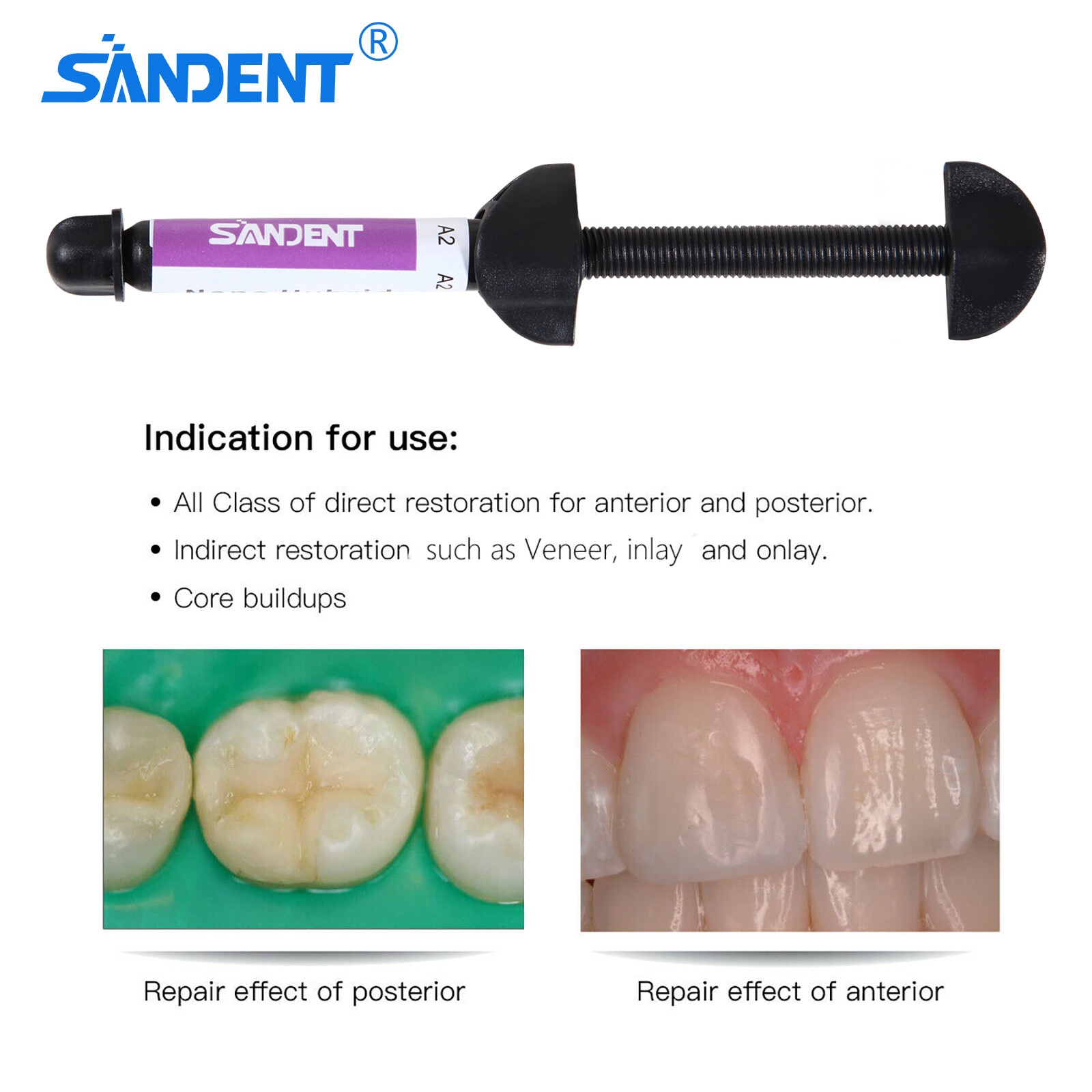 Dental Micro Hybrid Composite Light Cure Hybrid Resin Composite Syringe Shade-A2