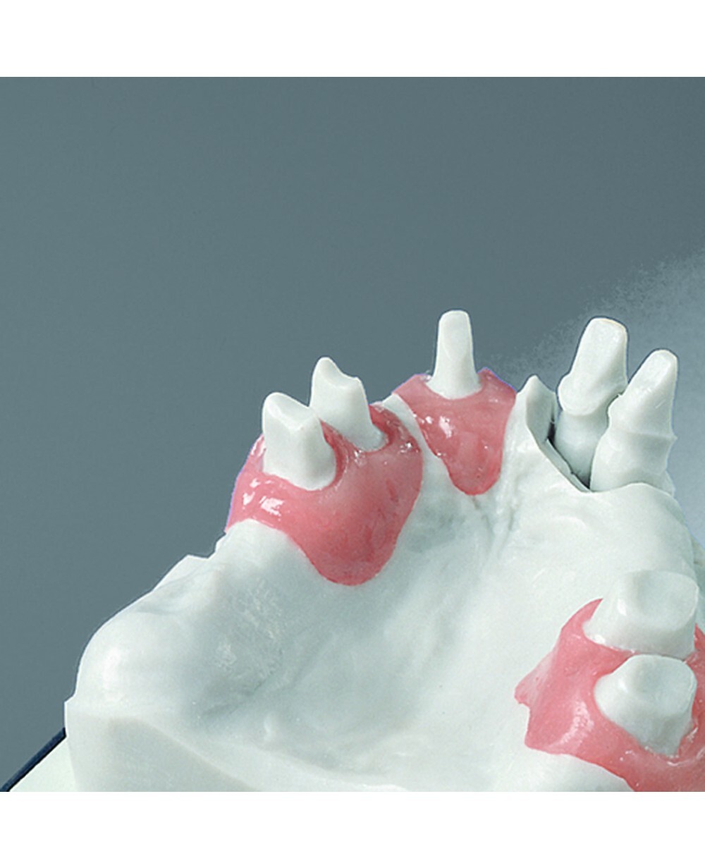 Vincismile Dental Lab Automix Flexible A-Silicone-Based for Gingival Masks