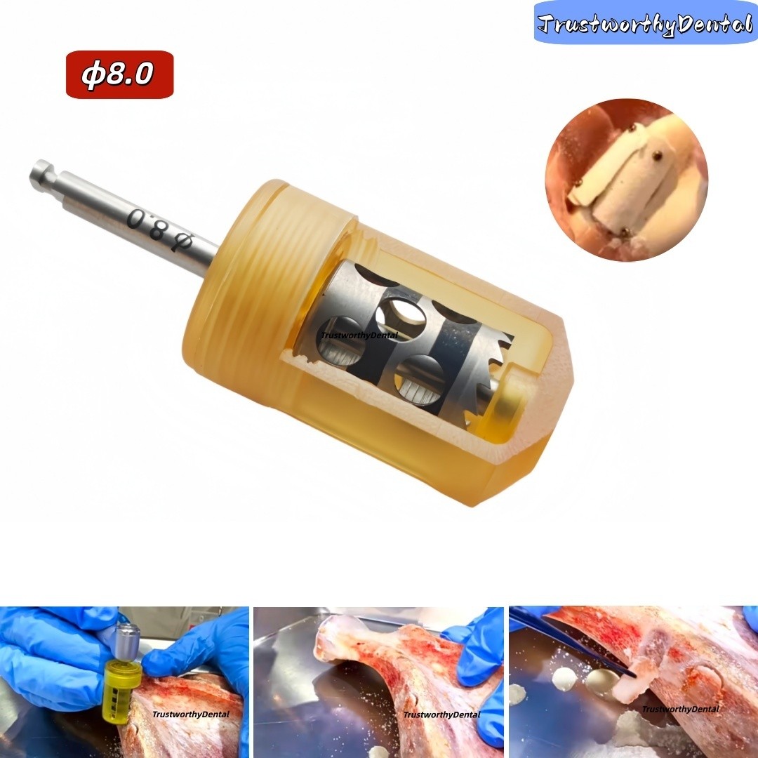 ⌀8.0 Dental Slt Half Moon Harvest Drill Bone Slice Drilling GBR Bone Collector