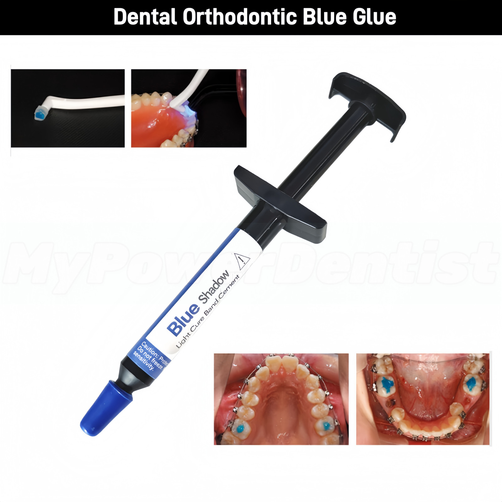 Dental TURBO Blue Glue Composite Resin Orthodontic Adhesive Light Cure Band 5ml