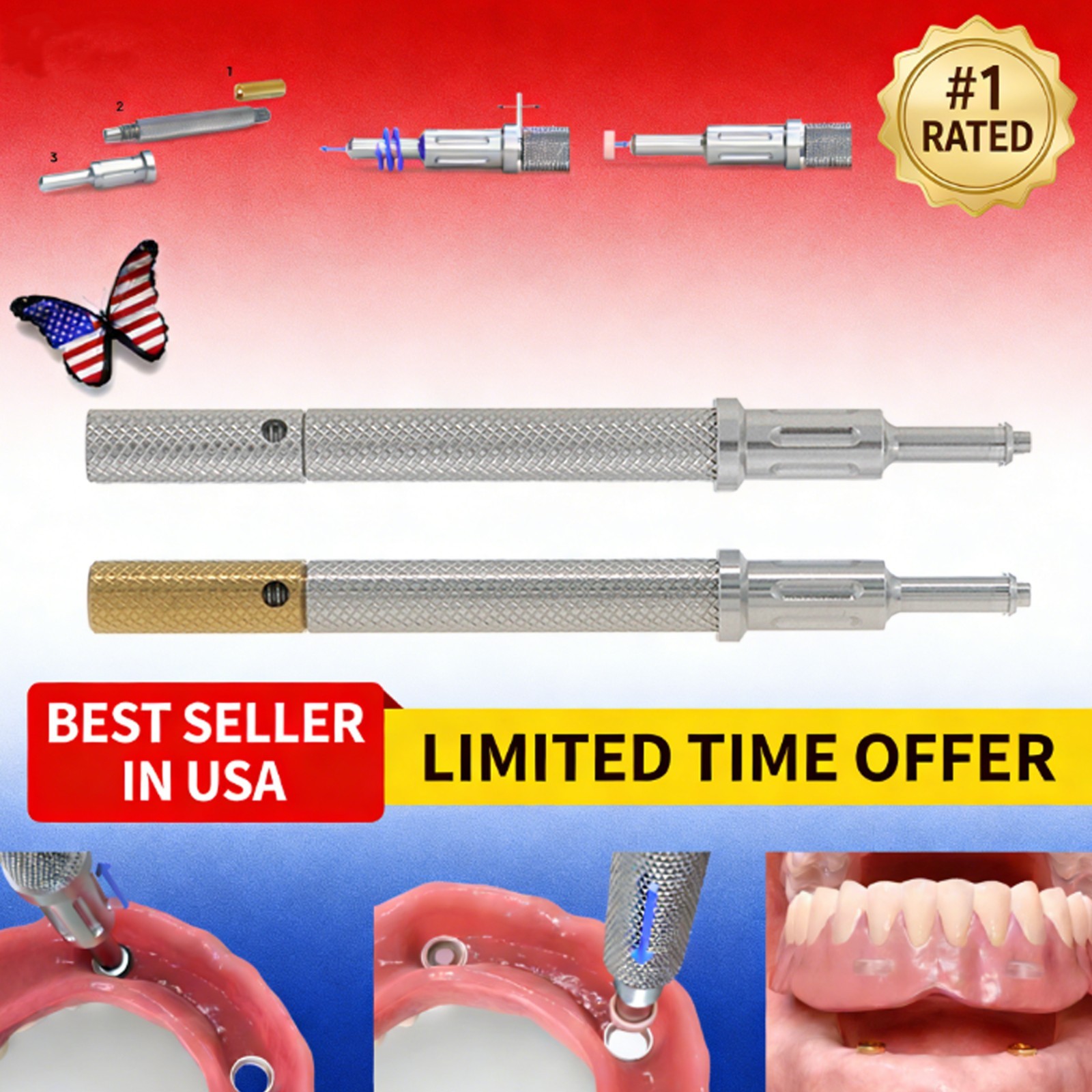 US Dental Locator Core Tool 3-in-1 Insertion Removal Driver Zest Locator Legacy