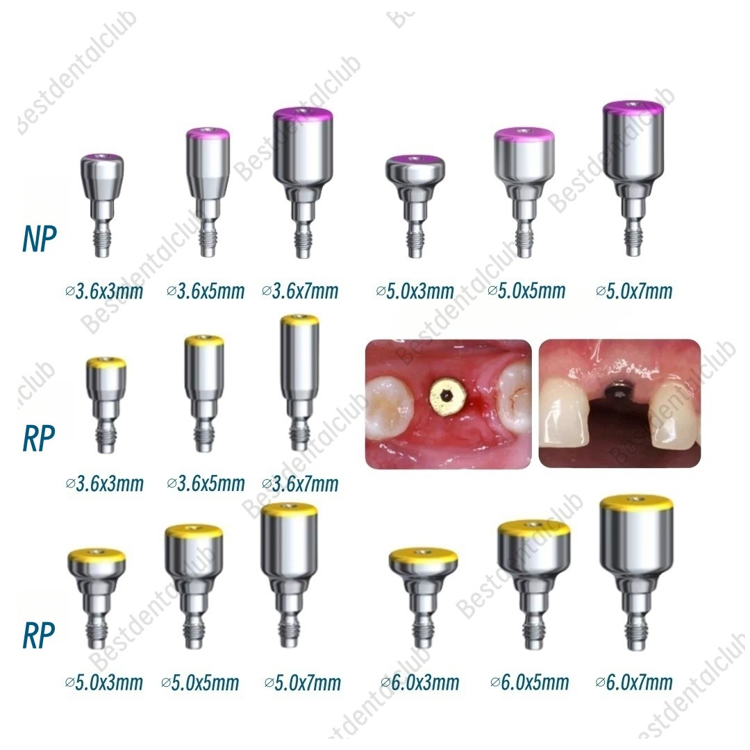 Nobel Healing Cap Abutment Dental RP/NP Compatible Nobel Active ∅3.6/5.0/6.0