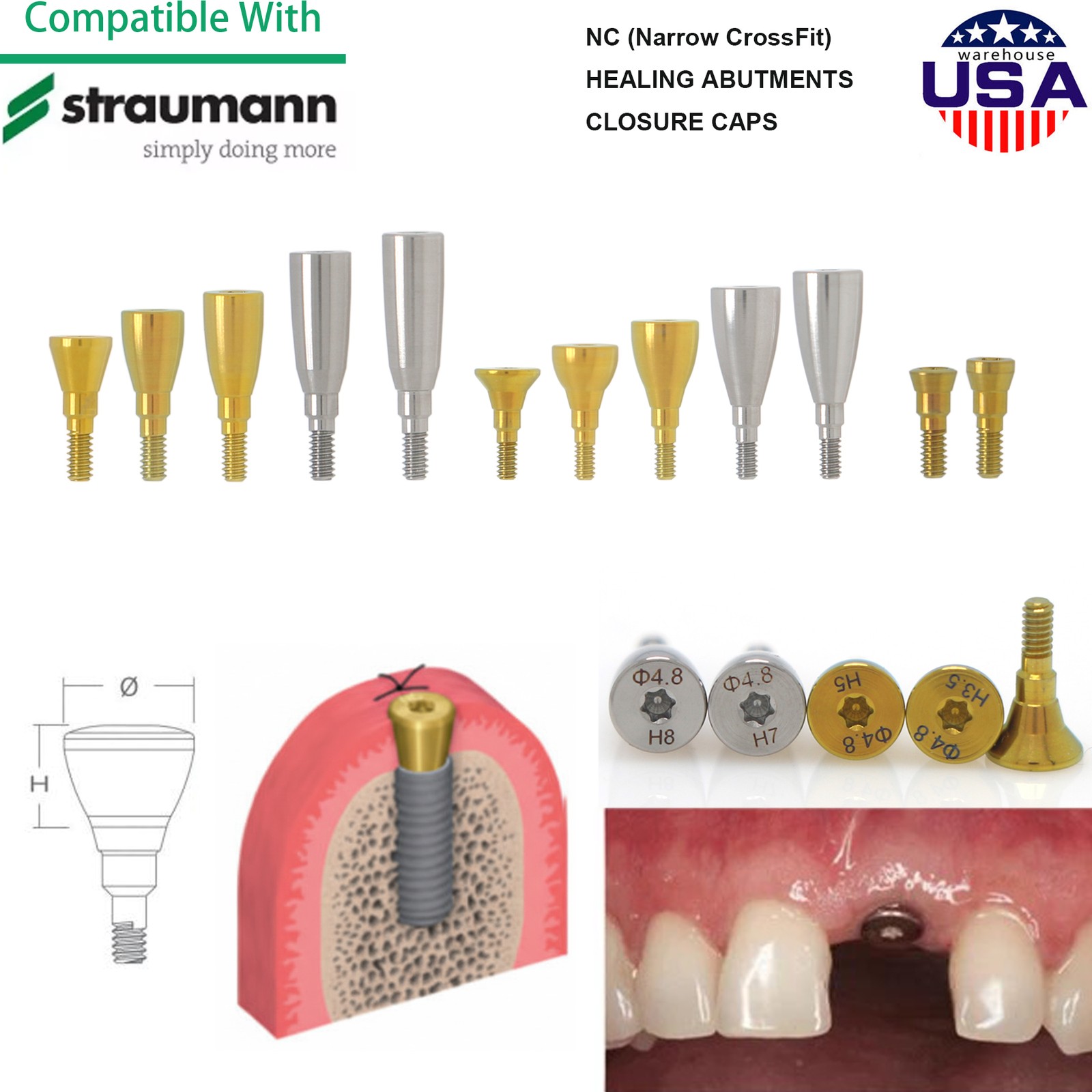 5Pcs Dental Healing Abutment & Closure Cap Fit Straumann BL/BLT NC RC Bone Level