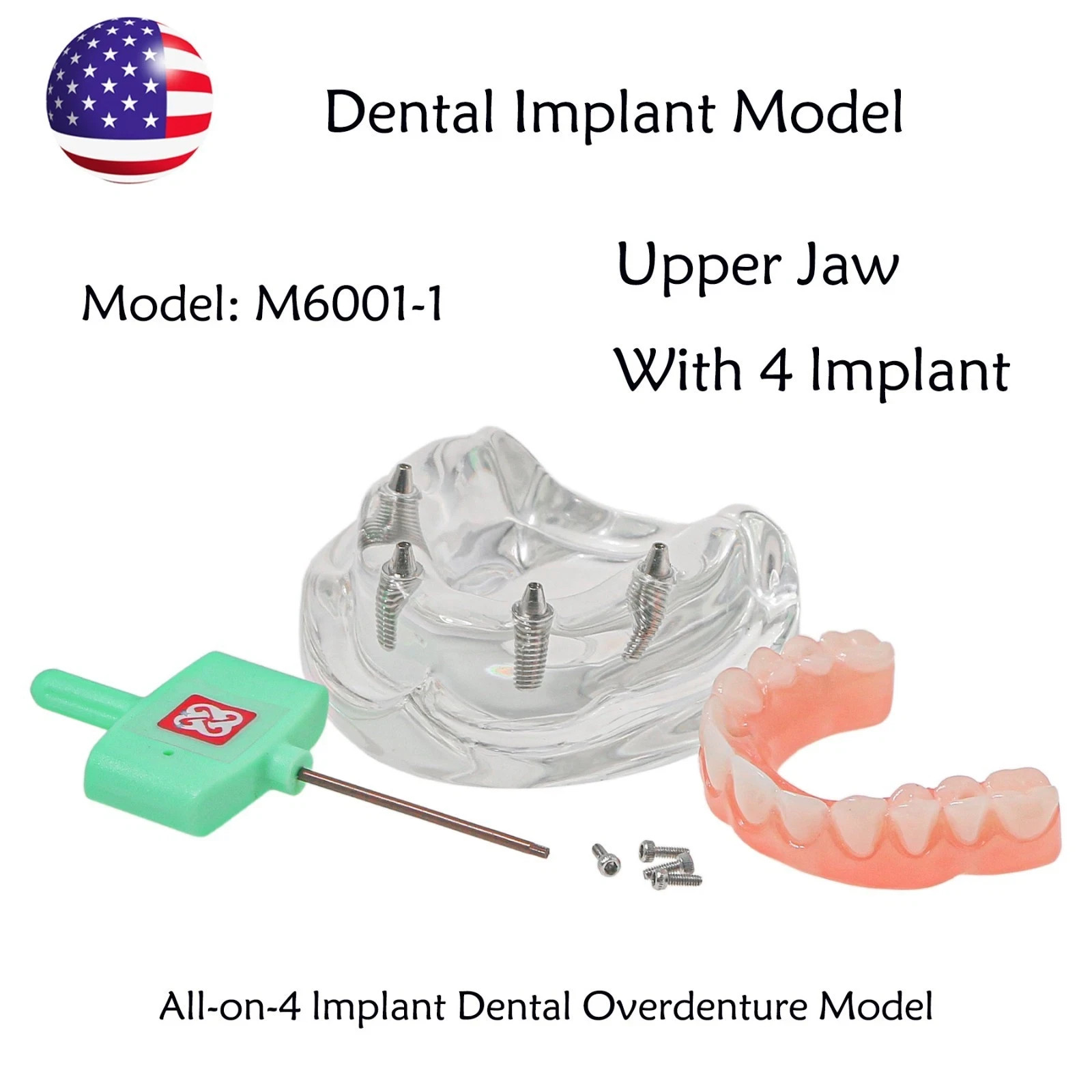 US Dental Overdenture All-on-4/6 Upper/Lower Jaw Teeth Model with 4/6 Screws