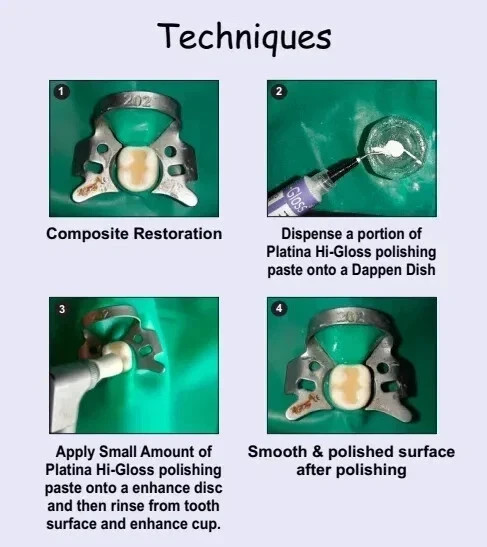 Dental PLATINA HI GLOSS Composite Polishing Paste for restorations & veneers 4gm