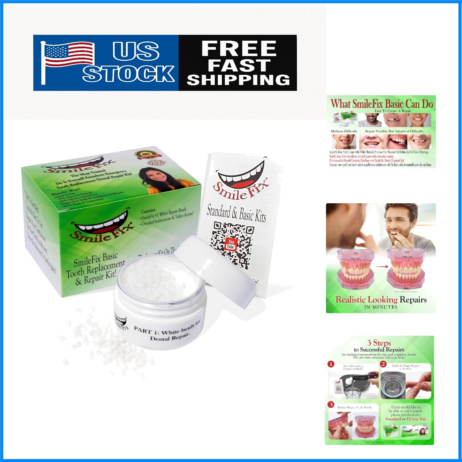 SmileFix Basic Dental Repair Kit – Moldable Beads for Missing Teeth & Gaps