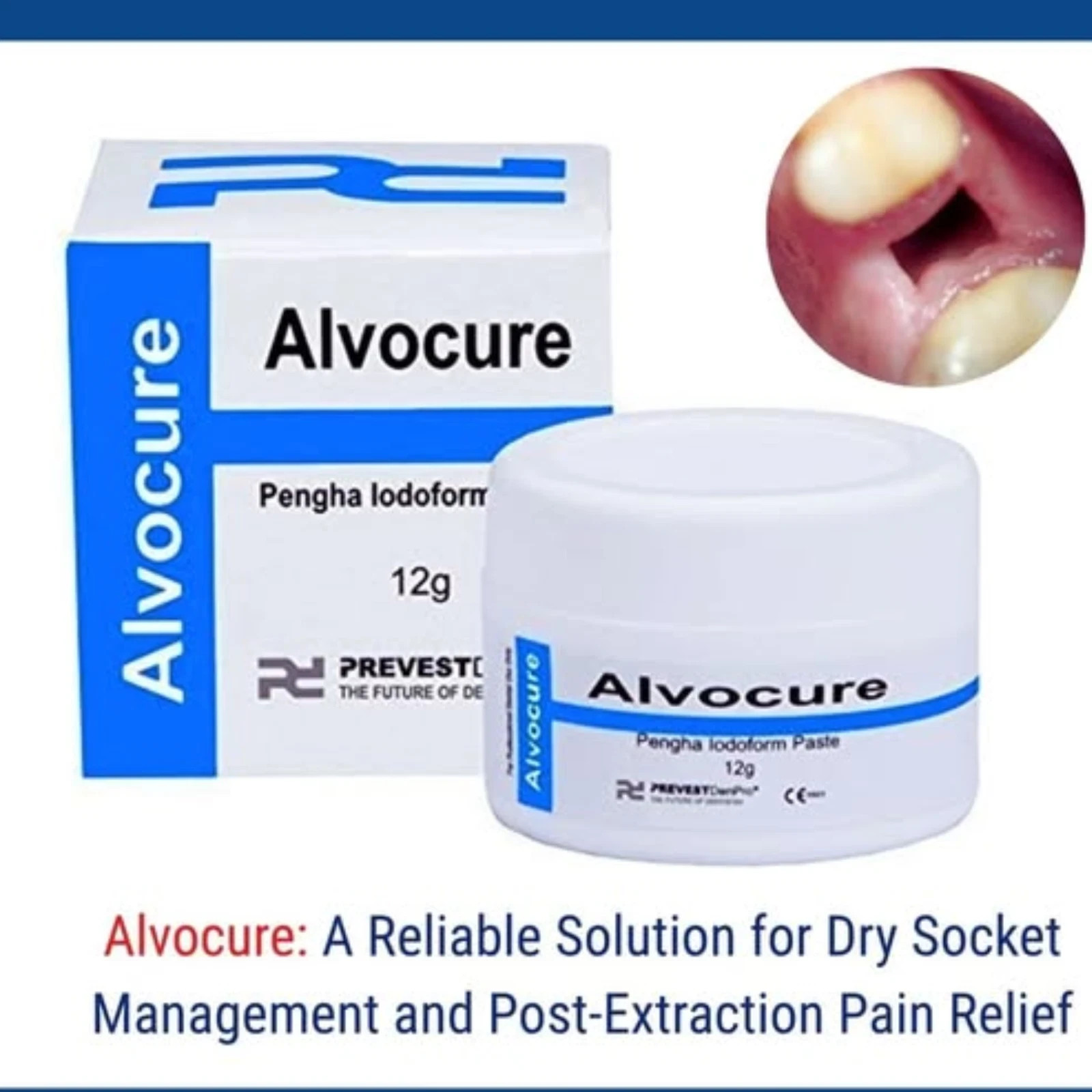 Alvocure Iodoform Paste Eugenol Dental Alveolar Dressing Analgesic Styptic 12g