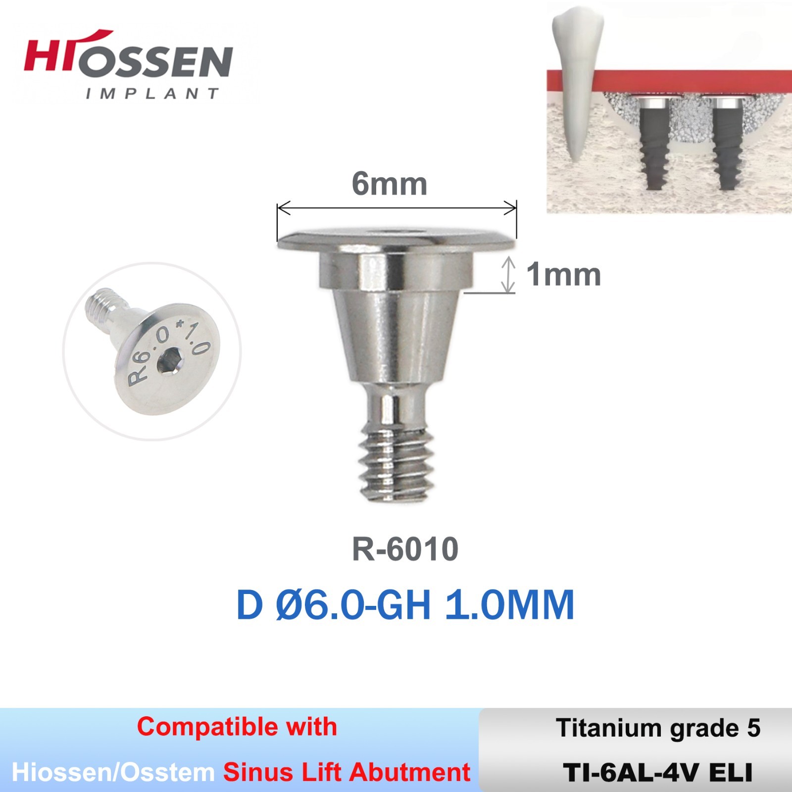 Implant Sinus Lift Temporary/Straight Transfer/Angled Abutments Fits Hiossen Oss