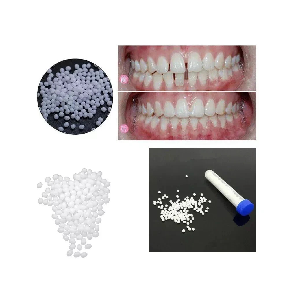 Dental Thermal Fitting Beads Replacement Temporary Tooth Denture 25g Material