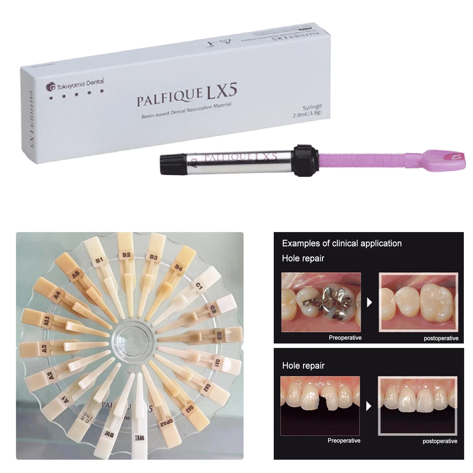 Tokuyama PALFIQUE LX5 3.8g Dental Restorative Composite – Free Shipping